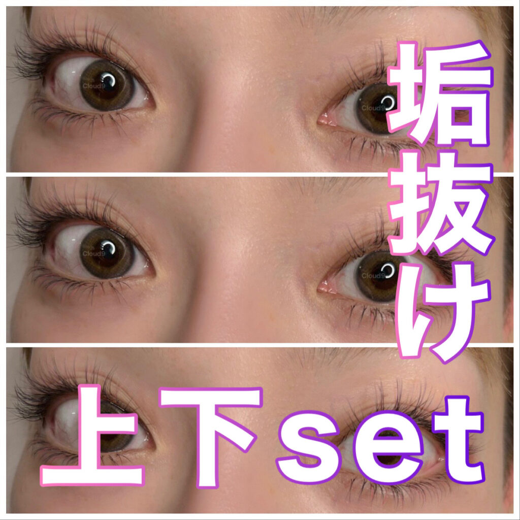 垢抜け上下SET＠香川県高松市マツエク | Eyelash Salon Cloud9 | 香川